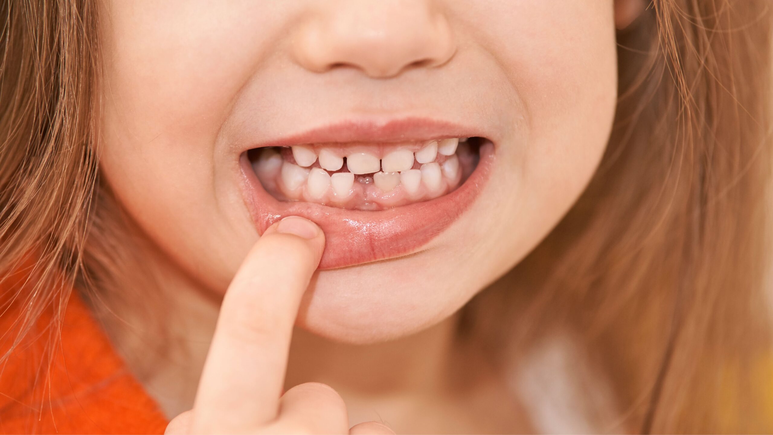Baby Teeth