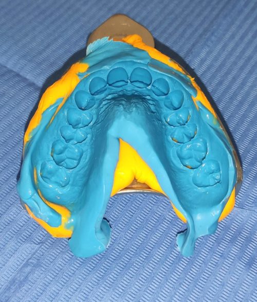 Figura-1