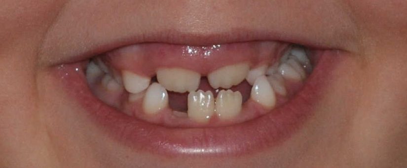 WHAT IS ORTHOPEDICS IN DENTISTRY?