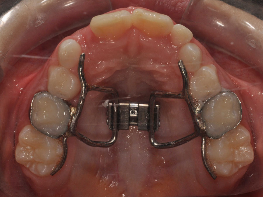 Orthopedics