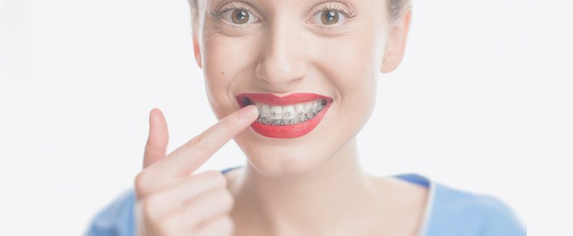 THE ERA OF ULTRA-RAPID ORTHODONTICS