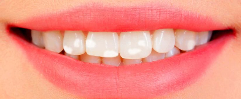 White Spots After Orthodontic Treatment: A Common Concern